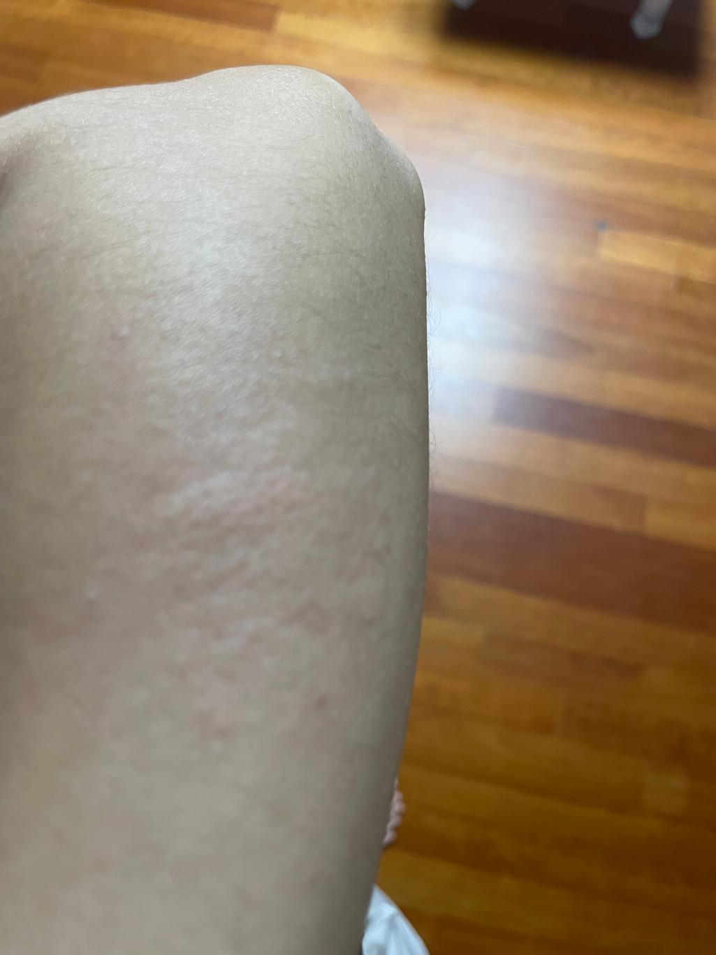 2번 째 사진