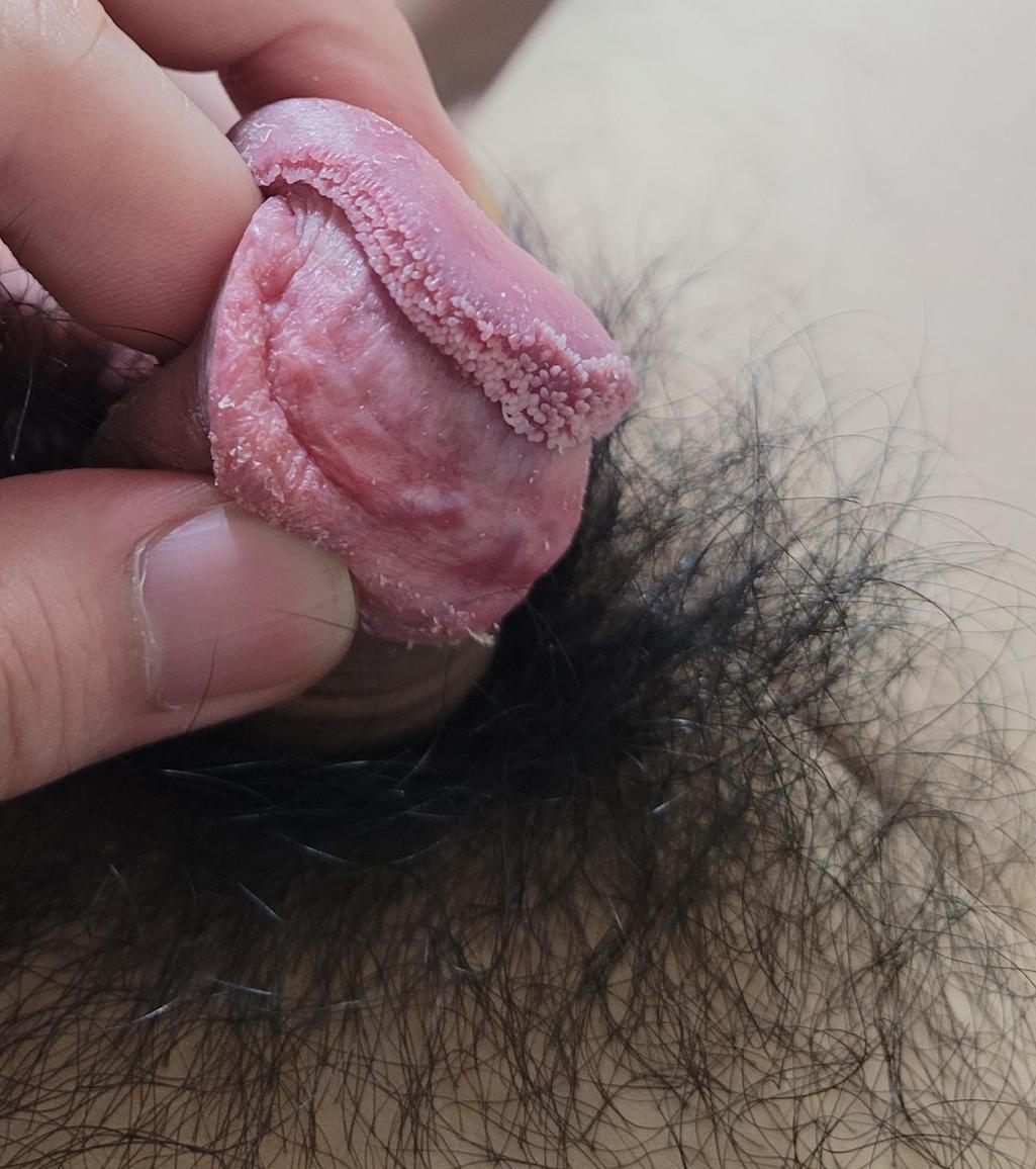 2번 째 사진