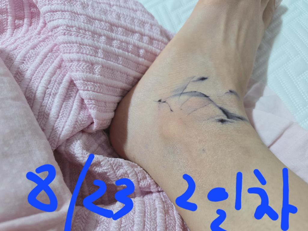 2번 째 사진