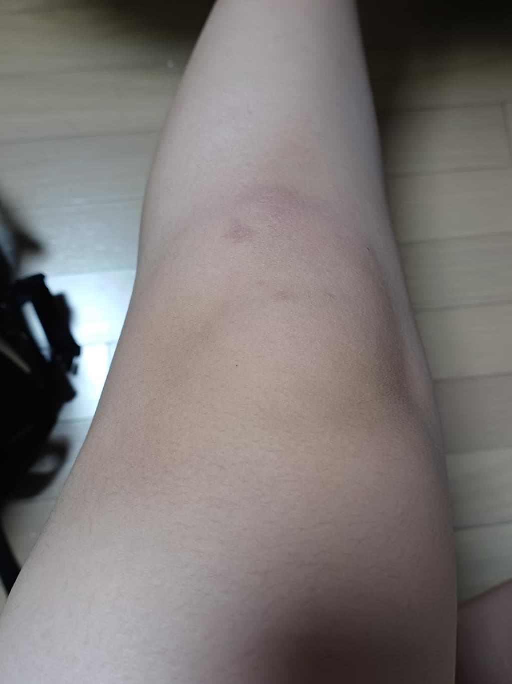 2번 째 사진