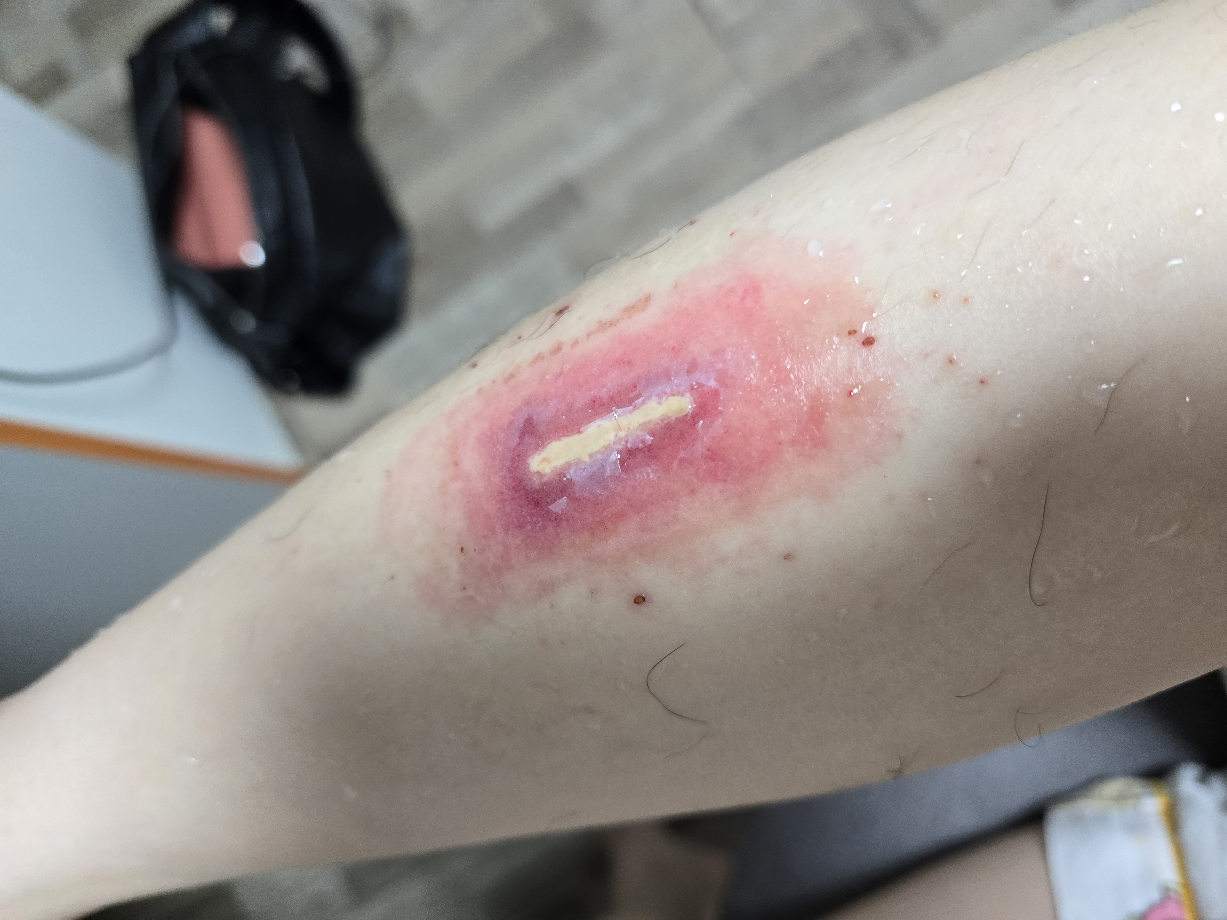 1번 째 사진