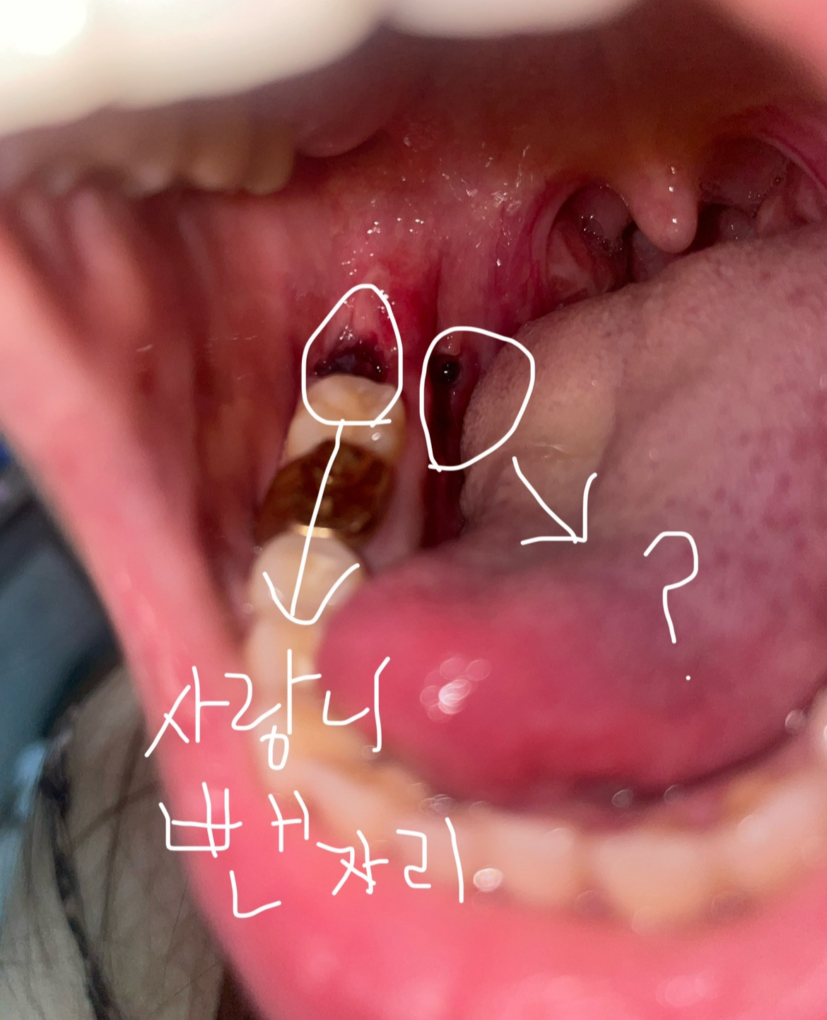 3번 째 사진