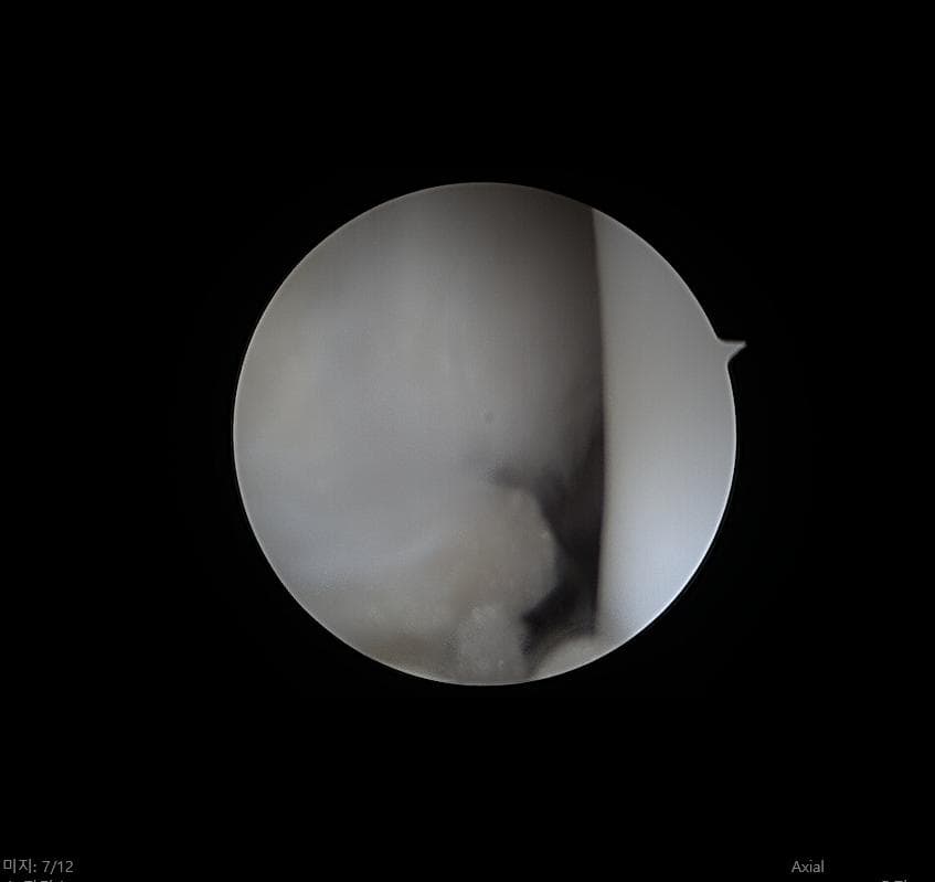 10번 째 사진