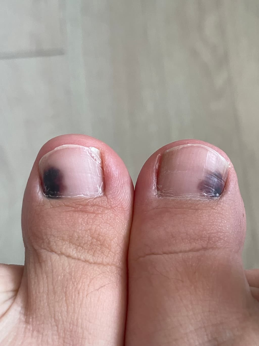 4번 째 사진