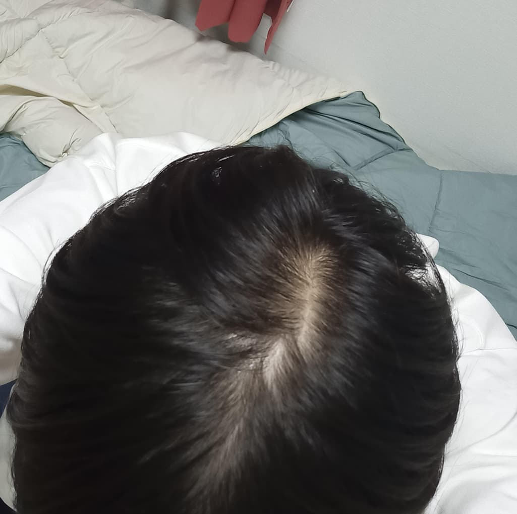 1번 째 사진
