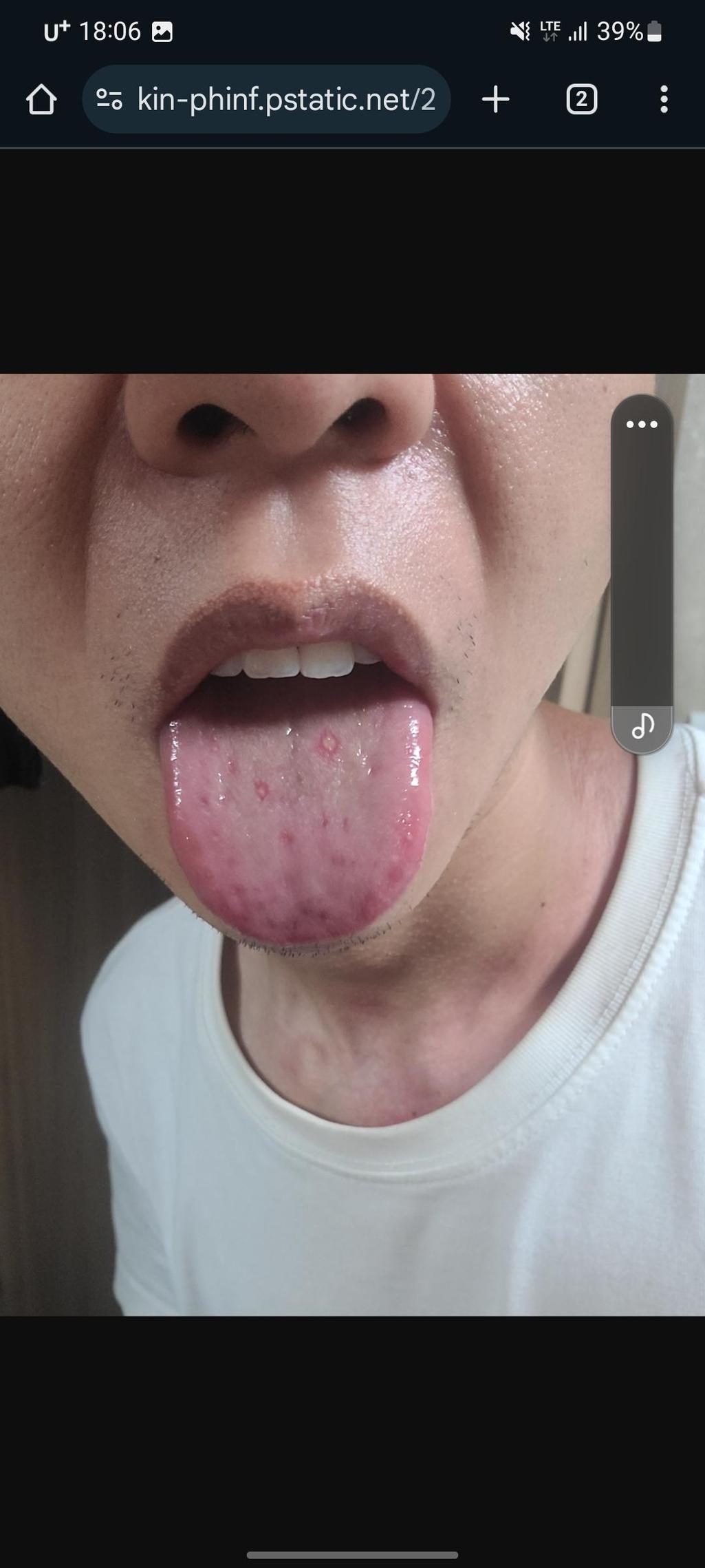 3번 째 사진