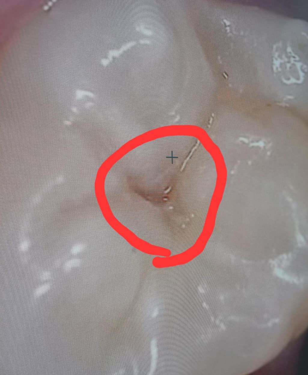2번 째 사진