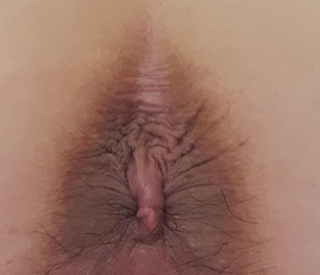 2번 째 사진