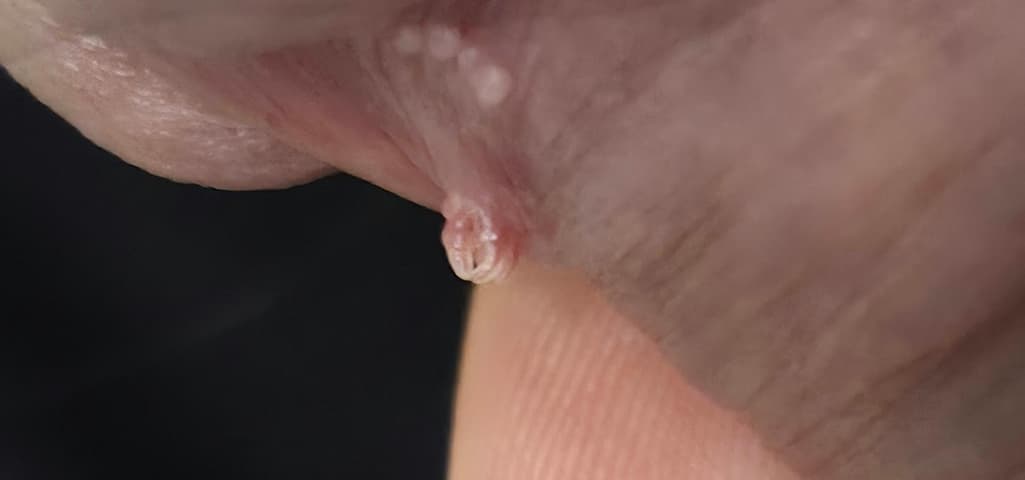 2번 째 사진