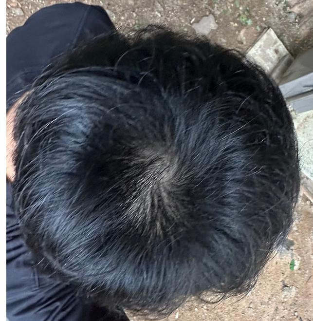 2번 째 사진