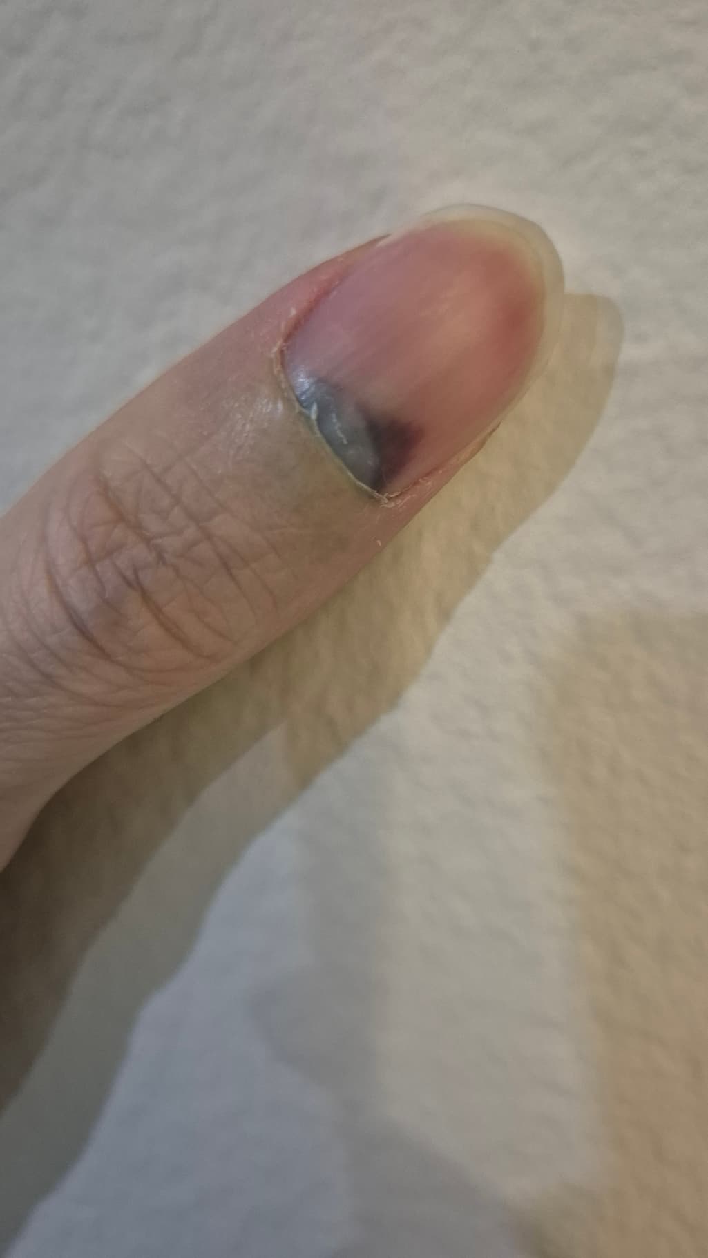 3번 째 사진