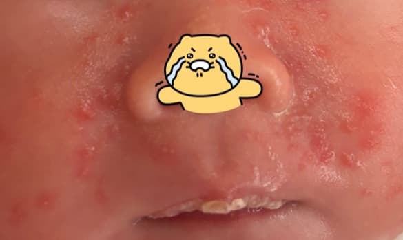 3번 째 사진