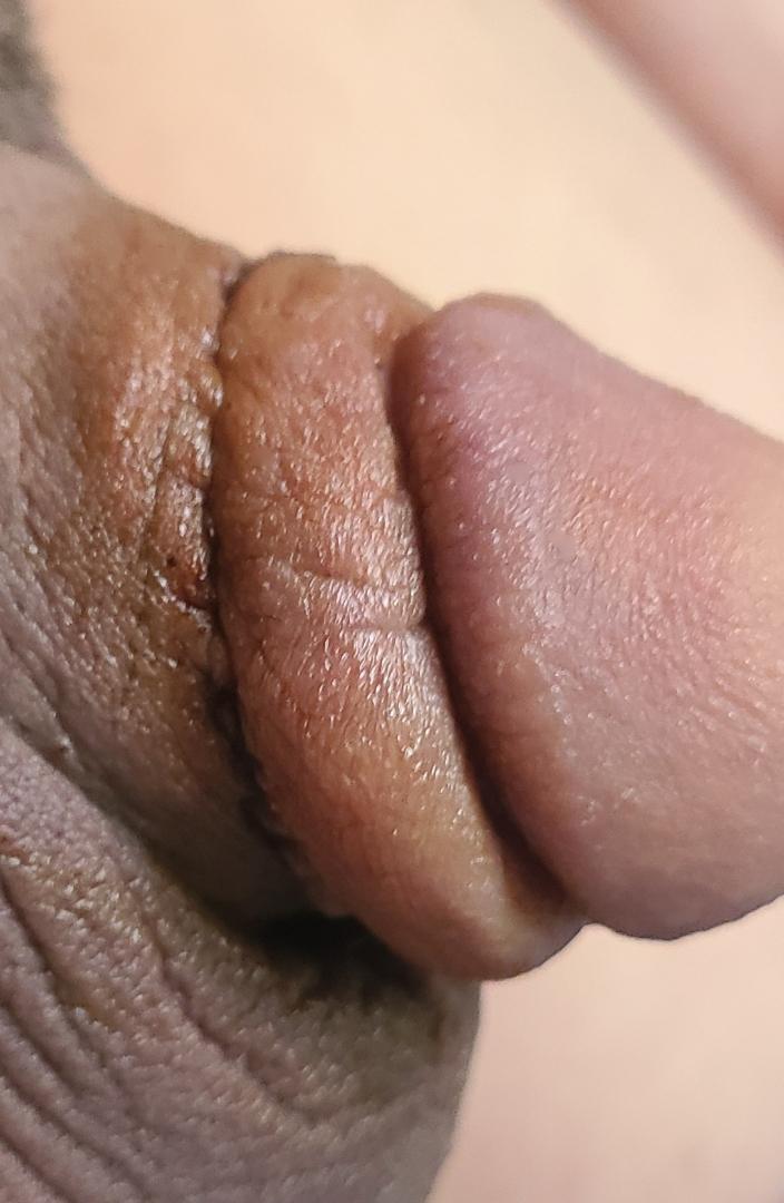 2번 째 사진