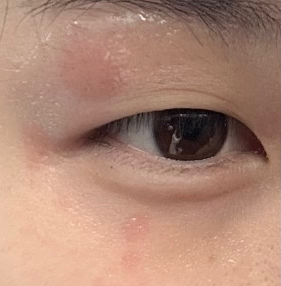 2번 째 사진