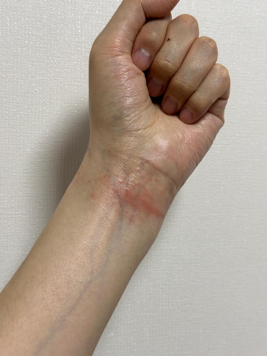 3번 째 사진