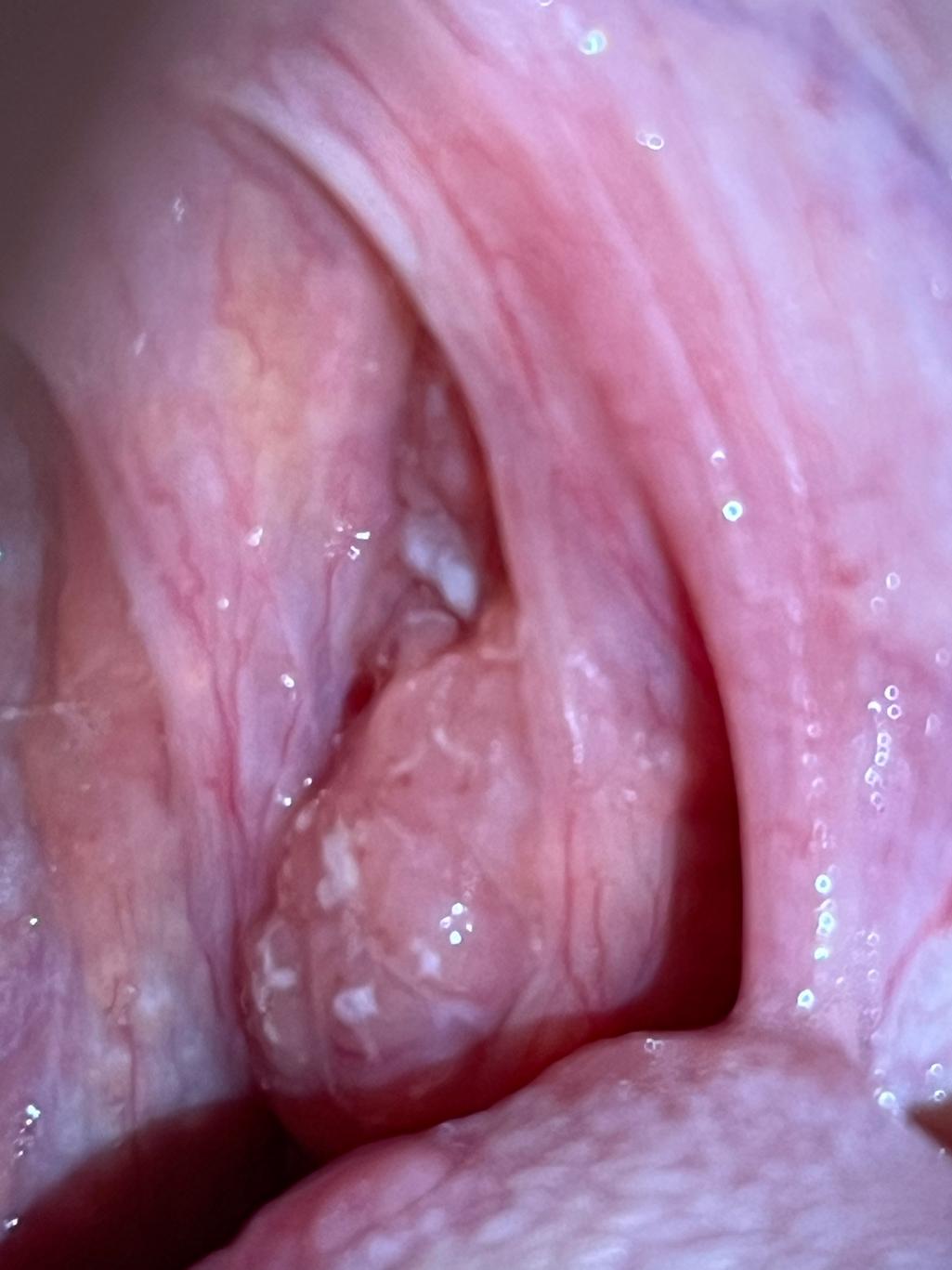 2번 째 사진