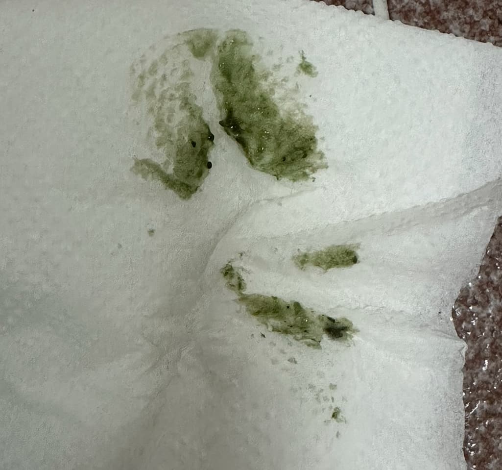 2번 째 사진