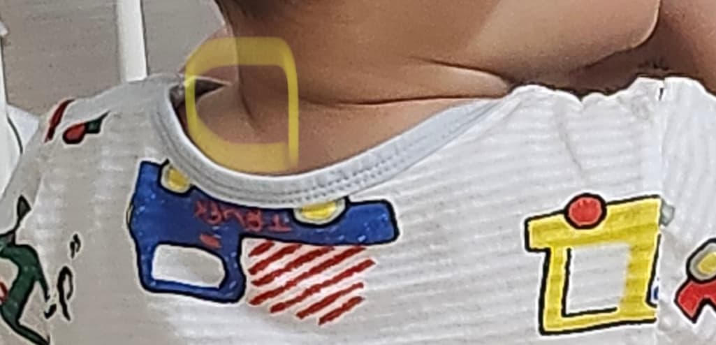 2번 째 사진