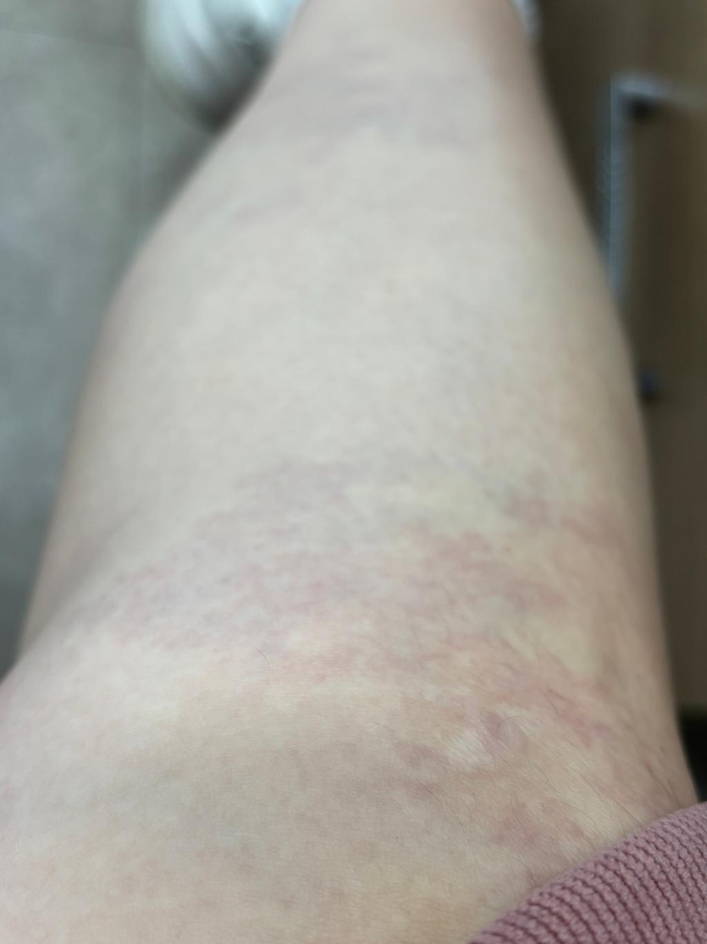 2번 째 사진
