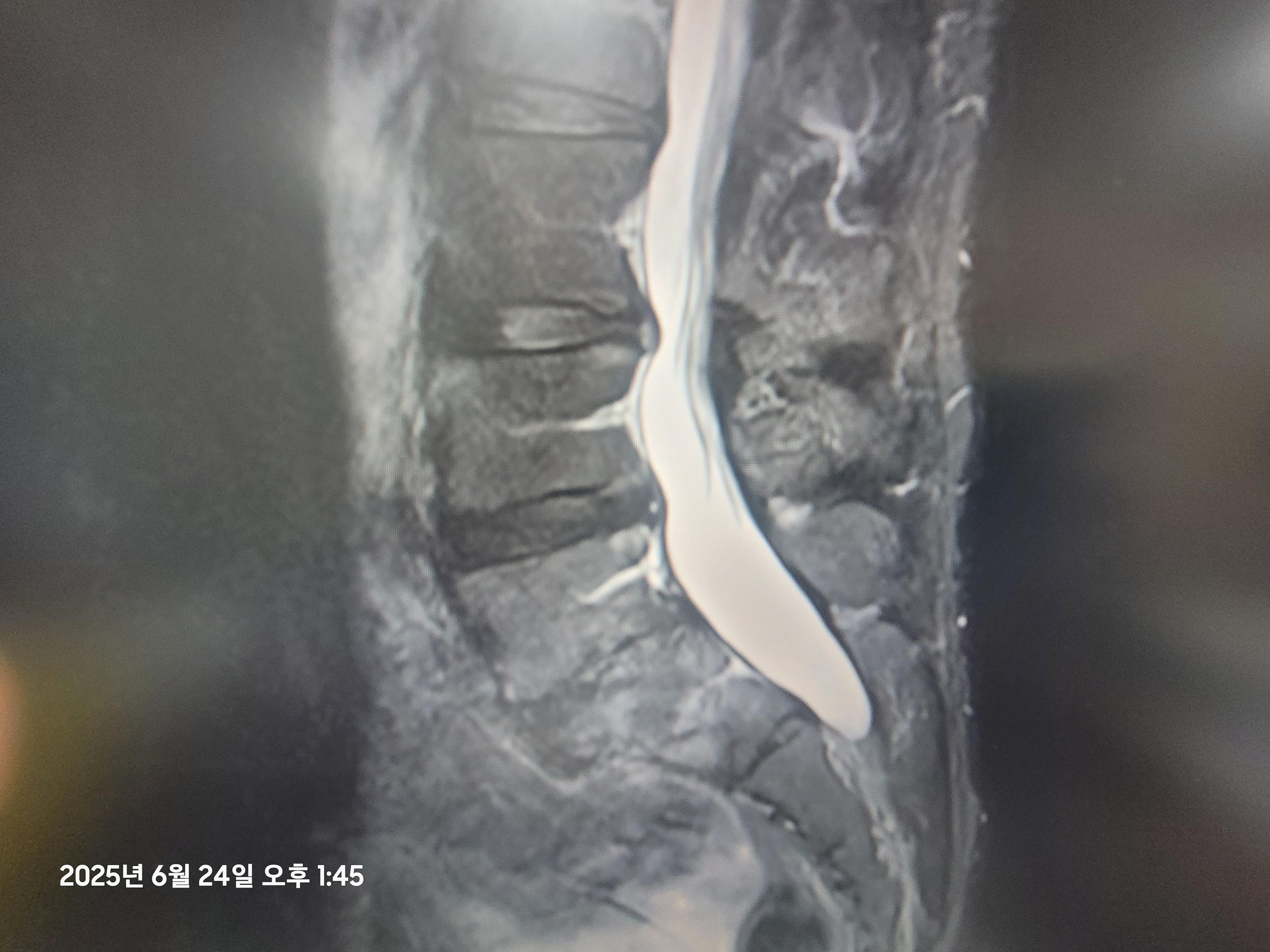 5번 째 사진