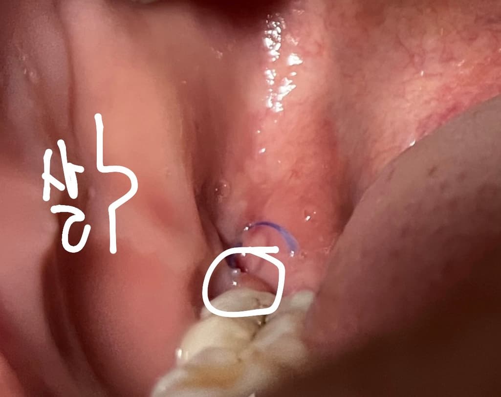 2번 째 사진