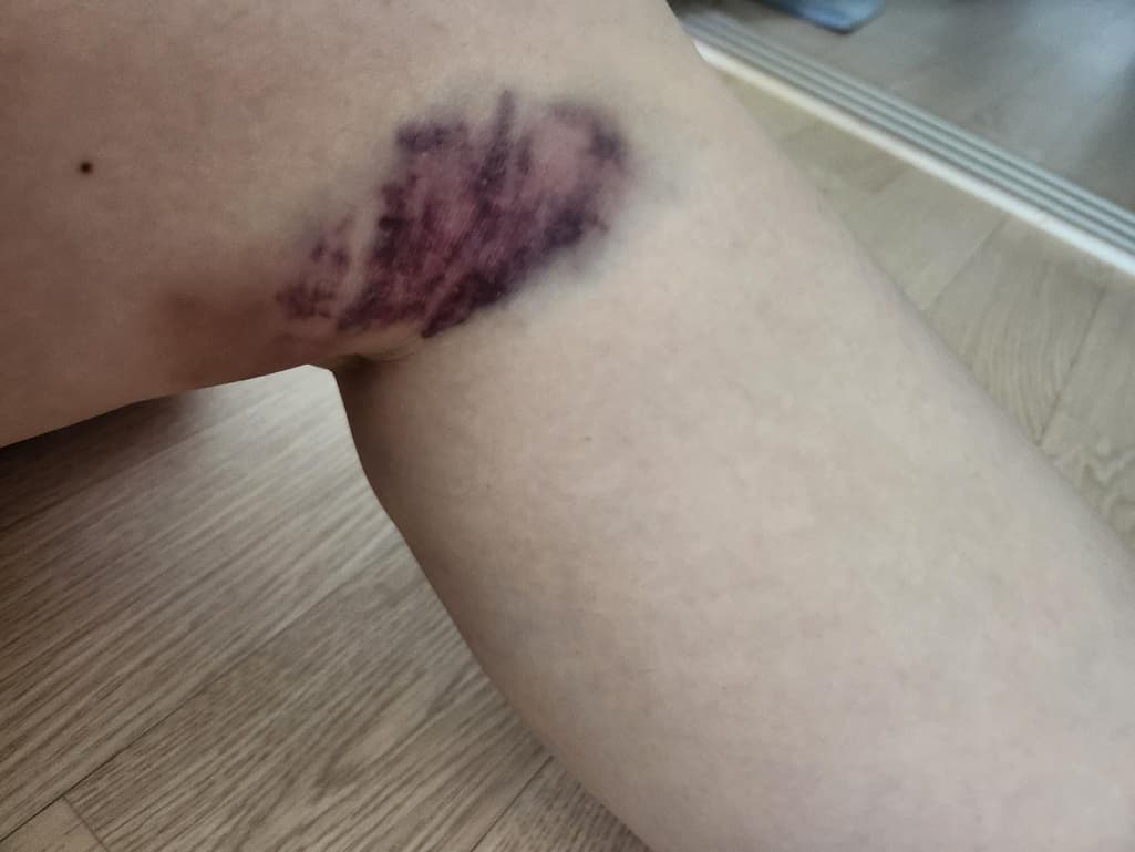 2번 째 사진