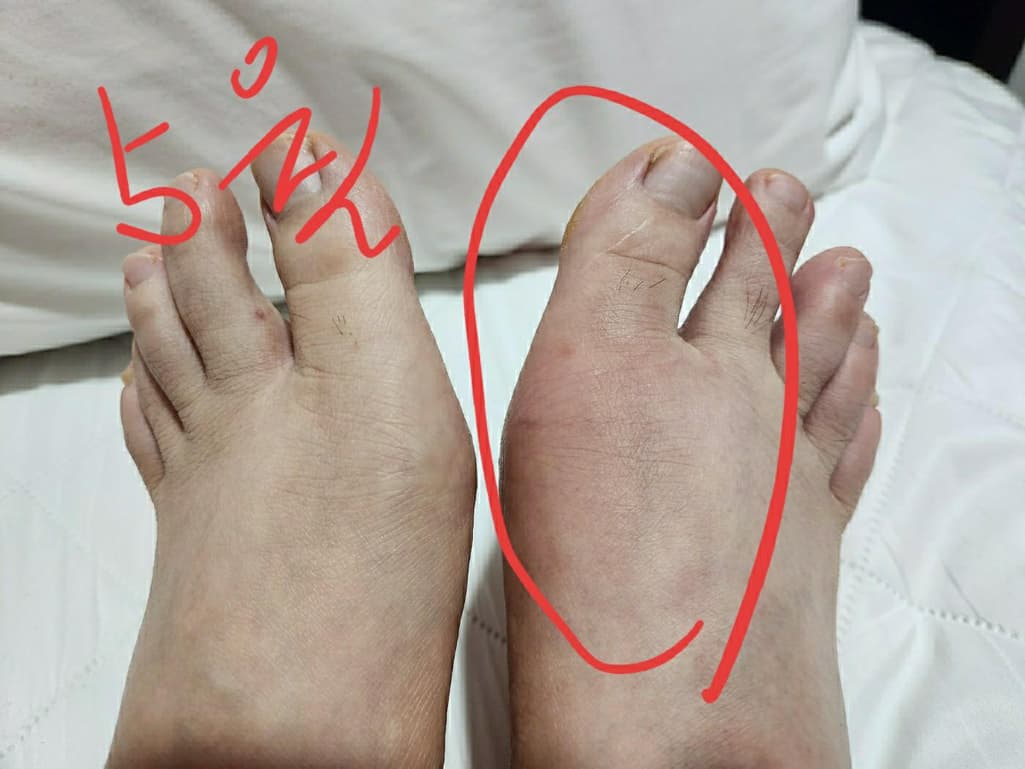 3번 째 사진