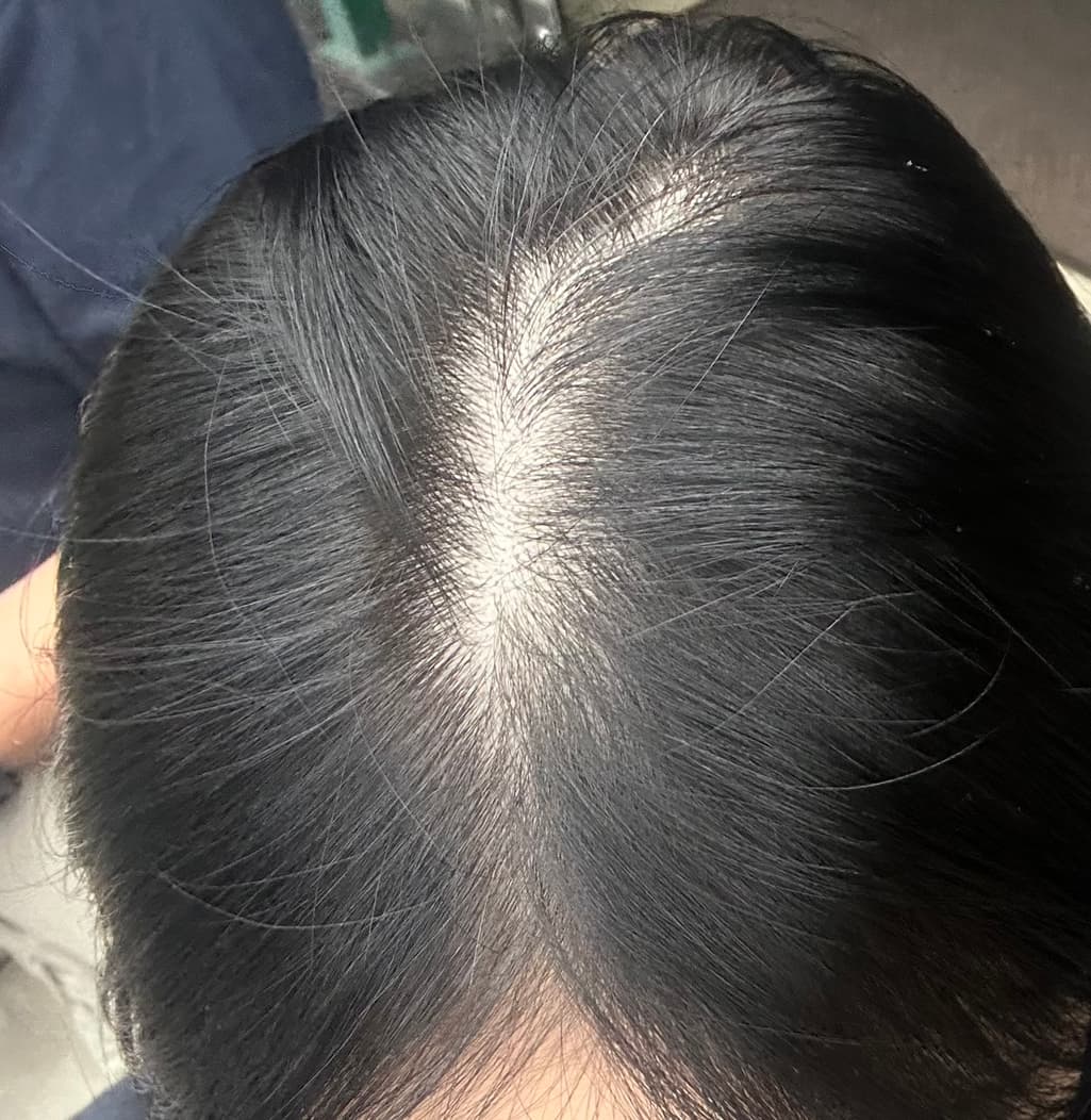 2번 째 사진