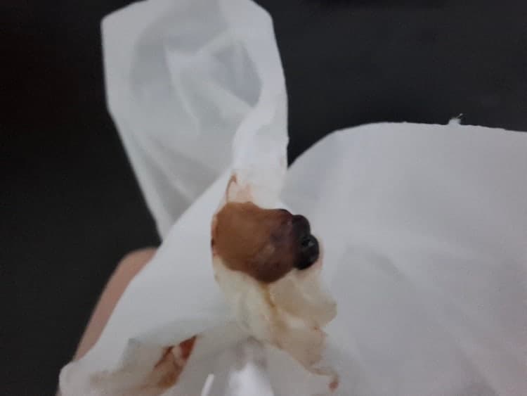 2번 째 사진