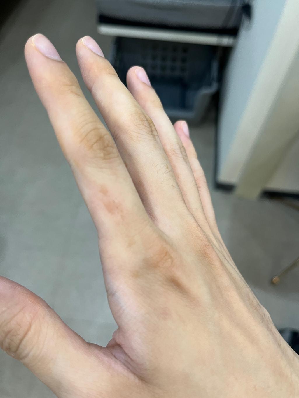 2번 째 사진