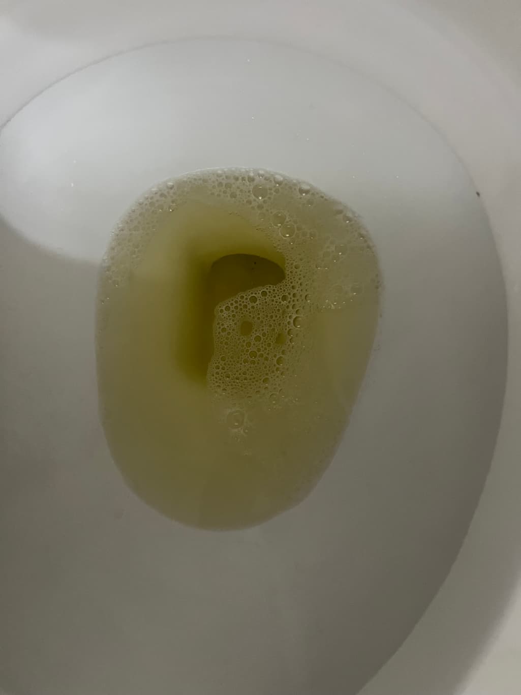 2번 째 사진