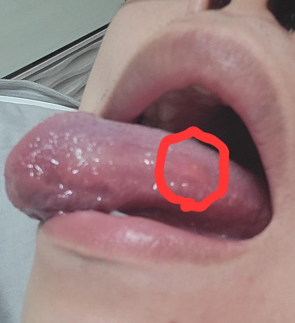 2번 째 사진