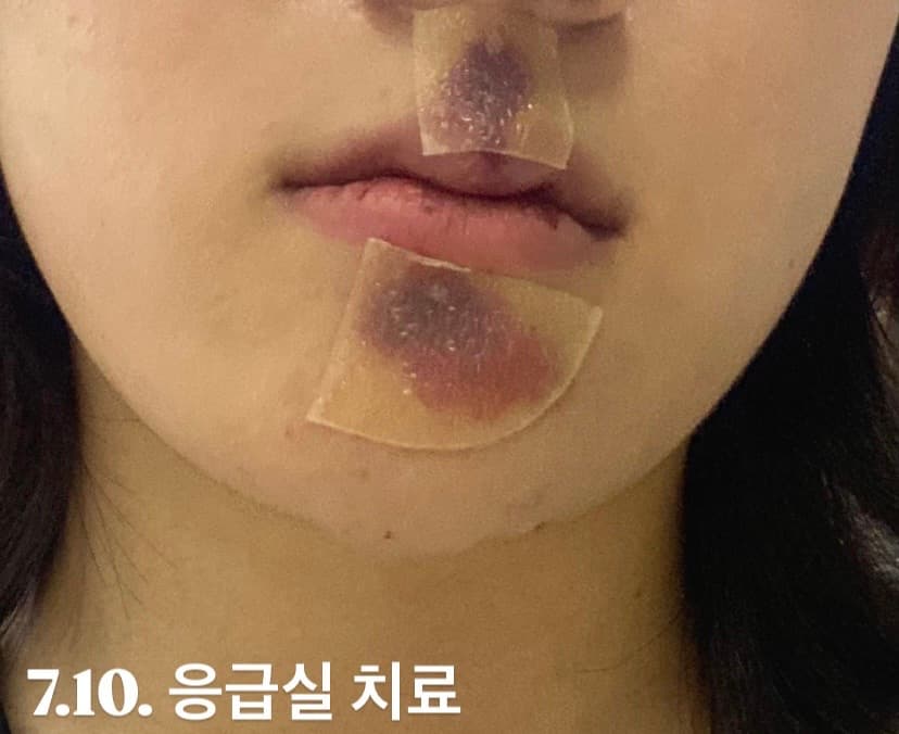 2번 째 사진