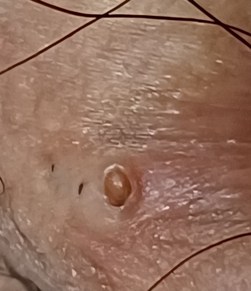 3번 째 사진