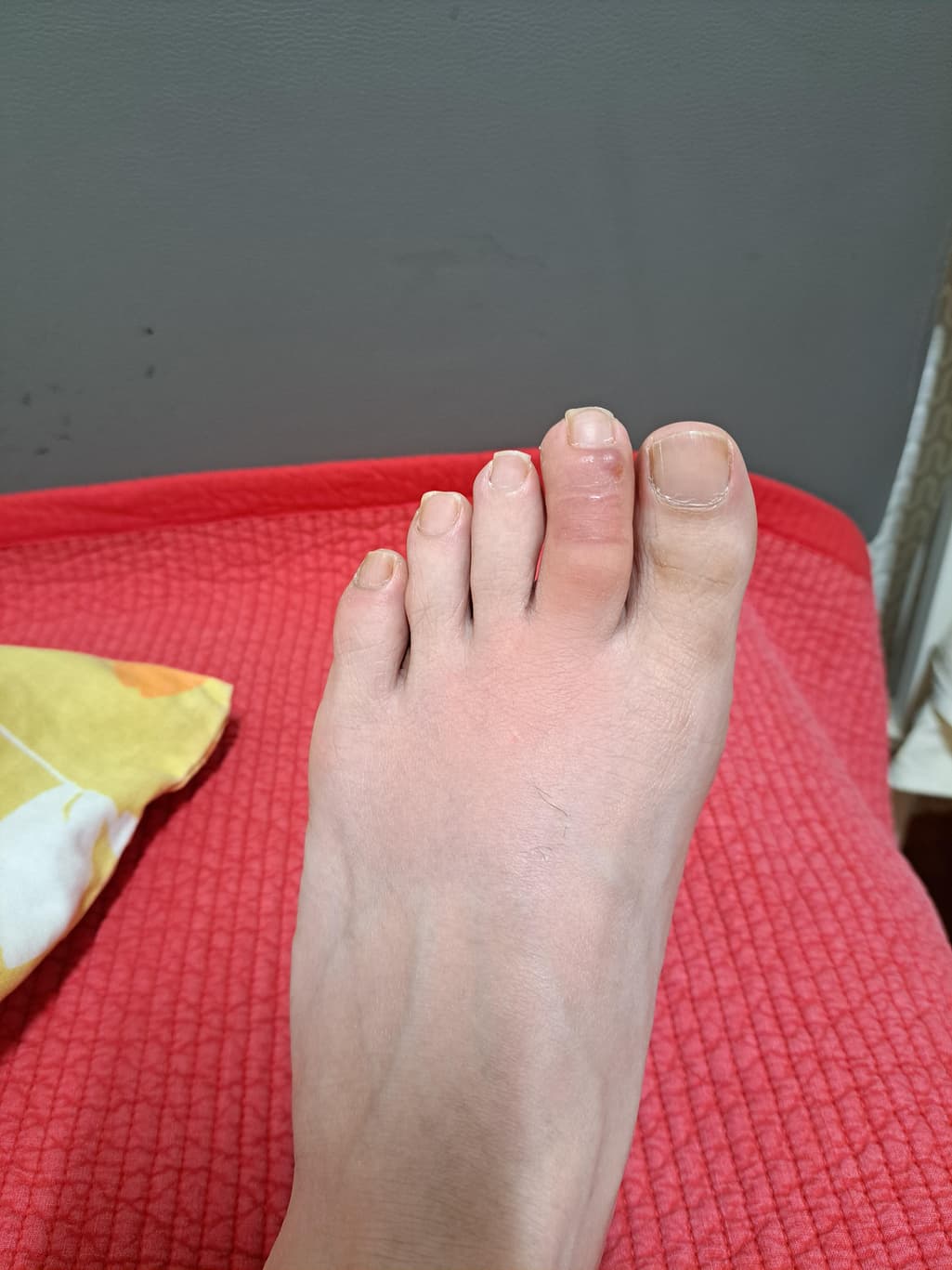1번 째 사진