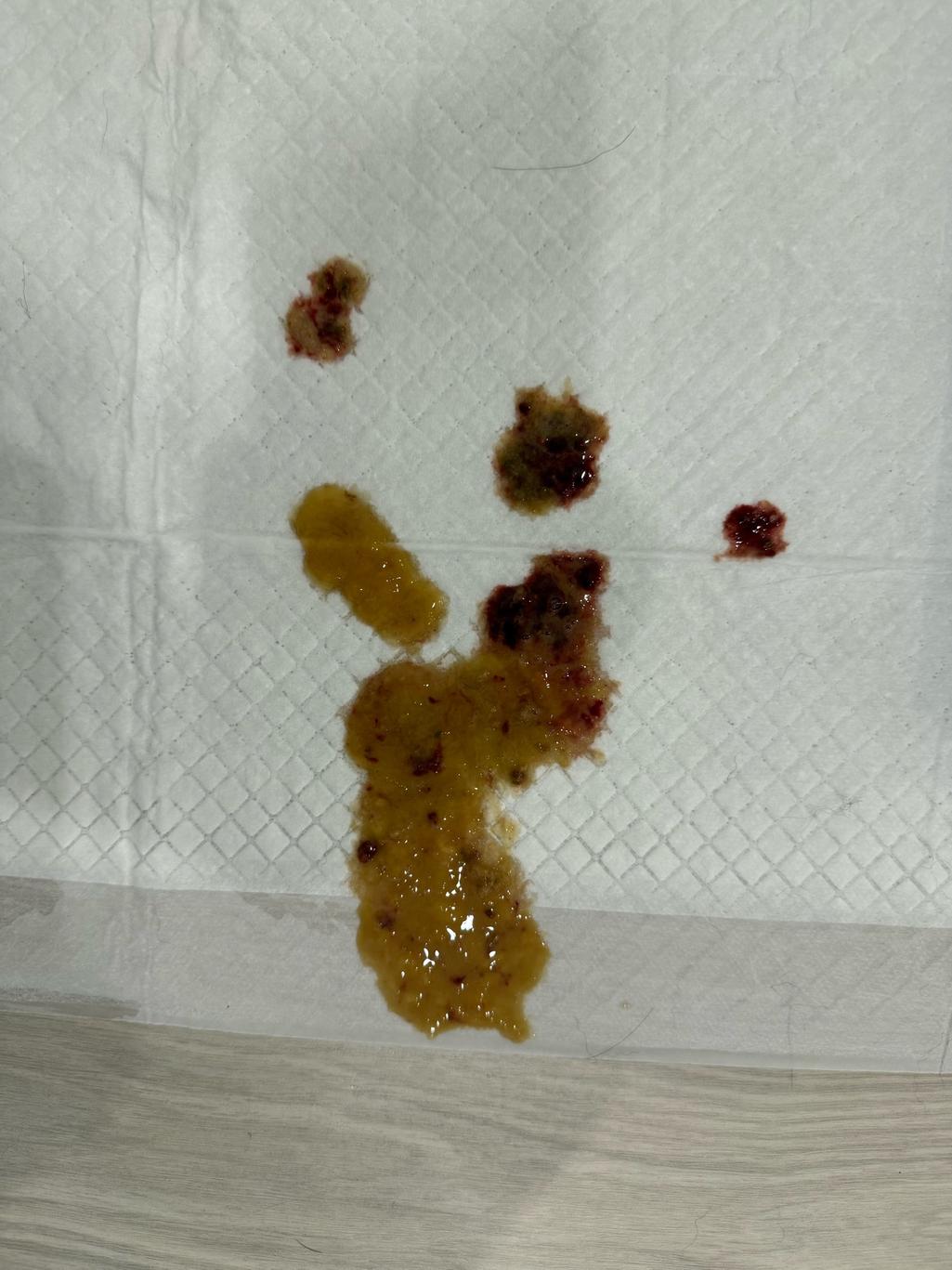 2번 째 사진
