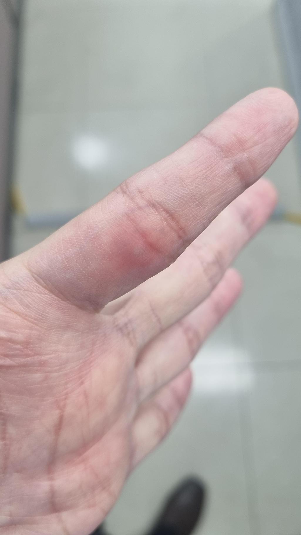2번 째 사진