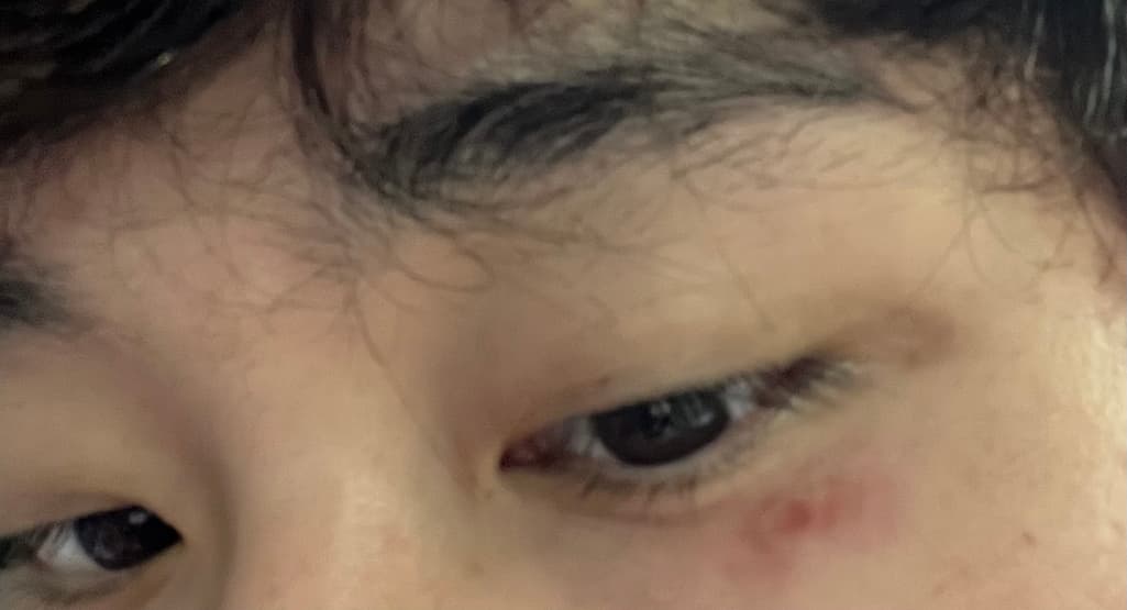 2번 째 사진