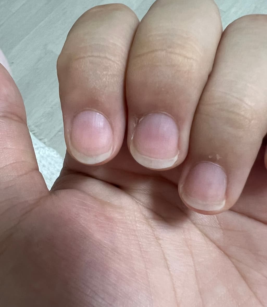 2번 째 사진