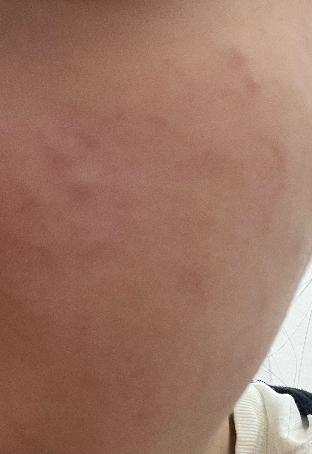2번 째 사진