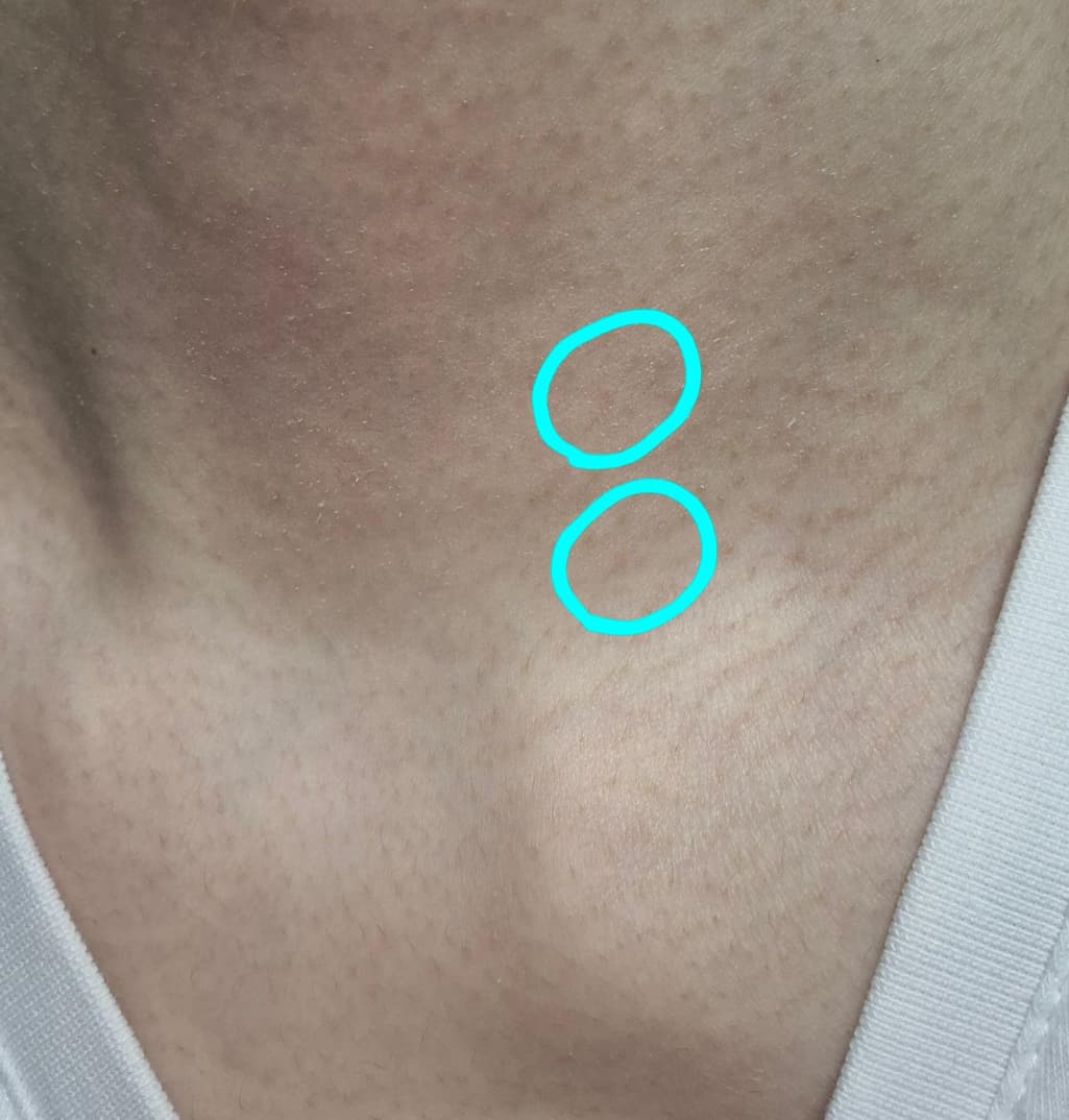 10번 째 사진