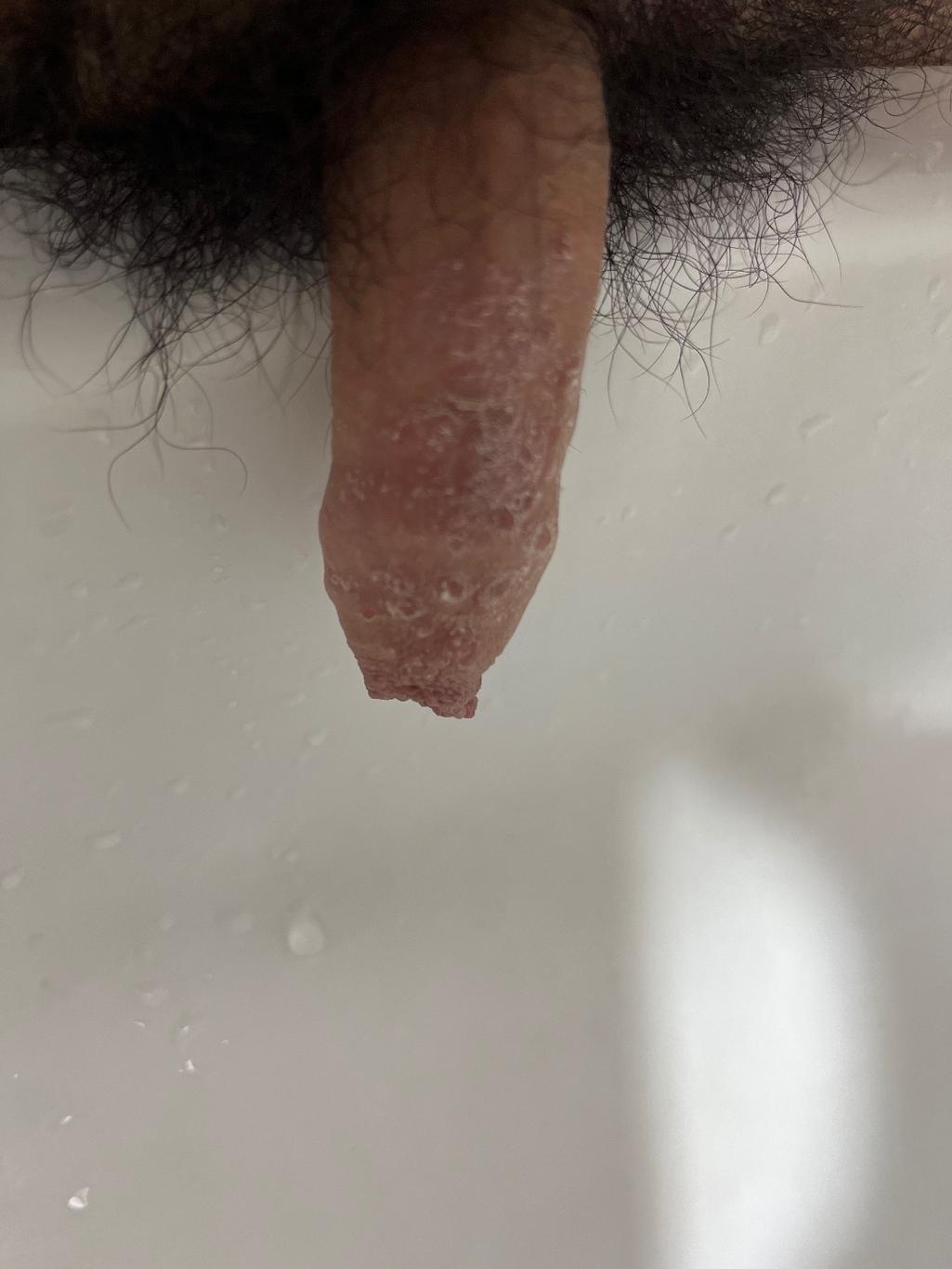 2번 째 사진