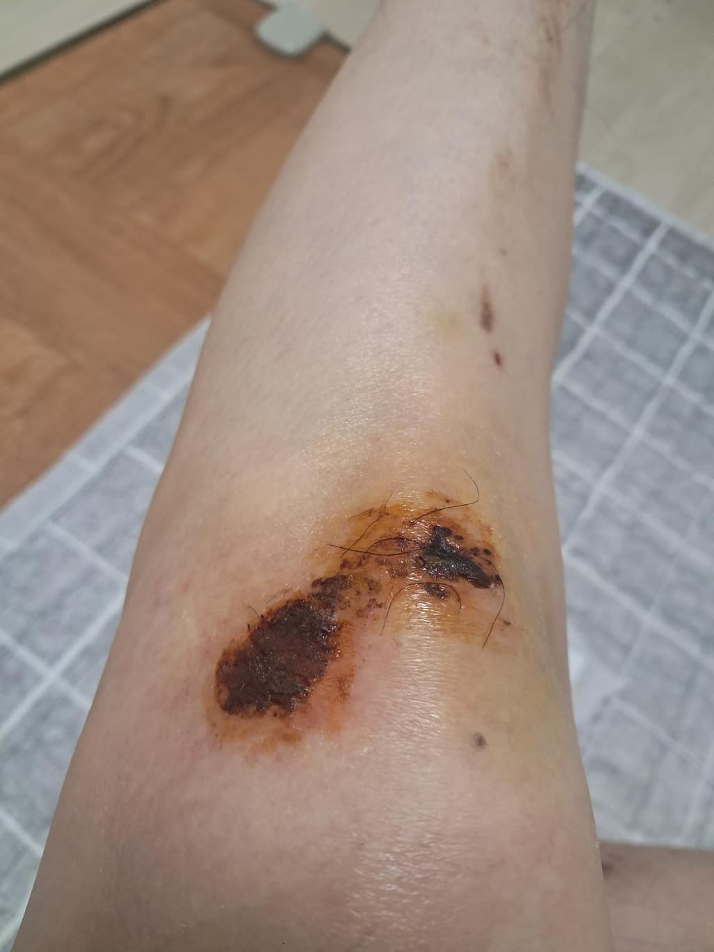 1번 째 사진