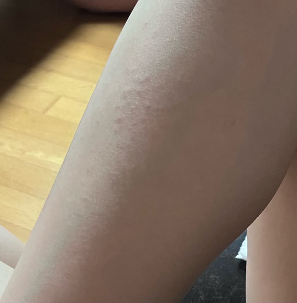 2번 째 사진