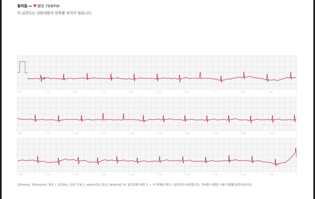 2번 째 사진
