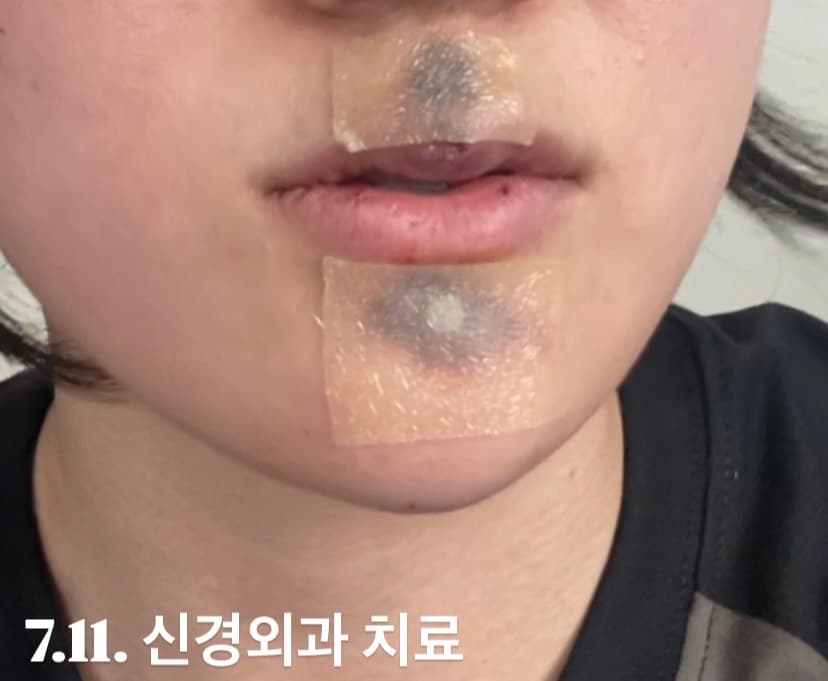 4번 째 사진