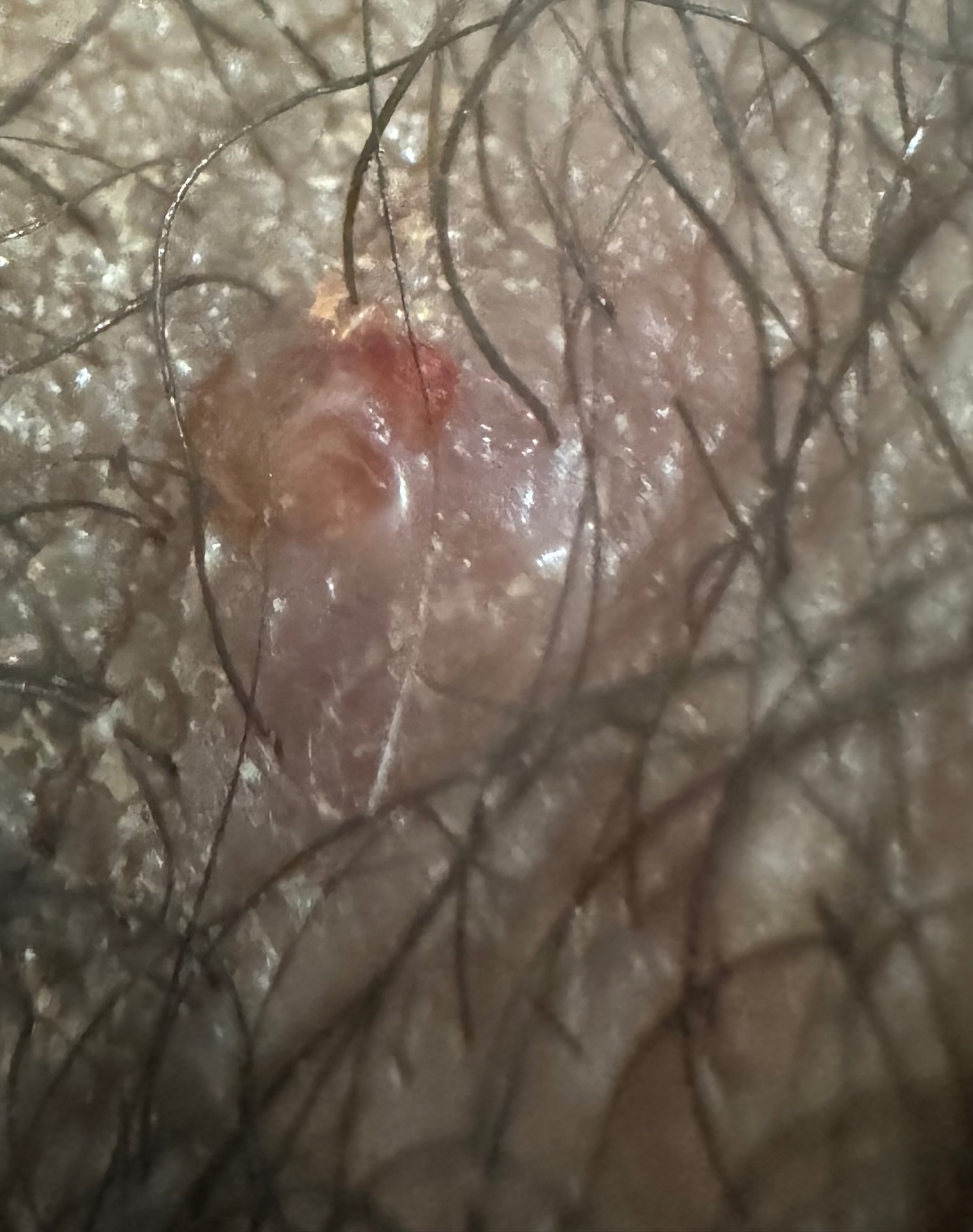 2번 째 사진
