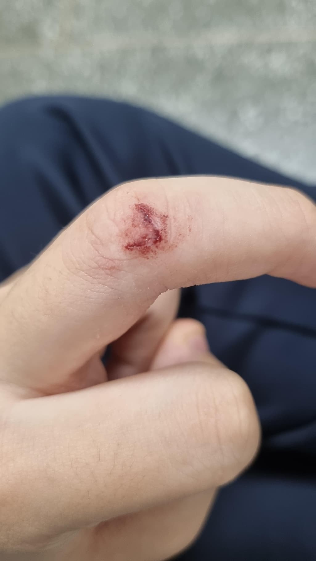 1번 째 사진