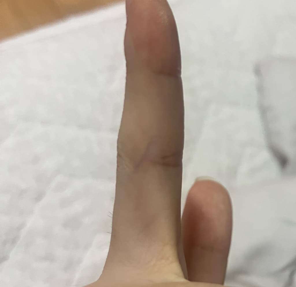 2번 째 사진