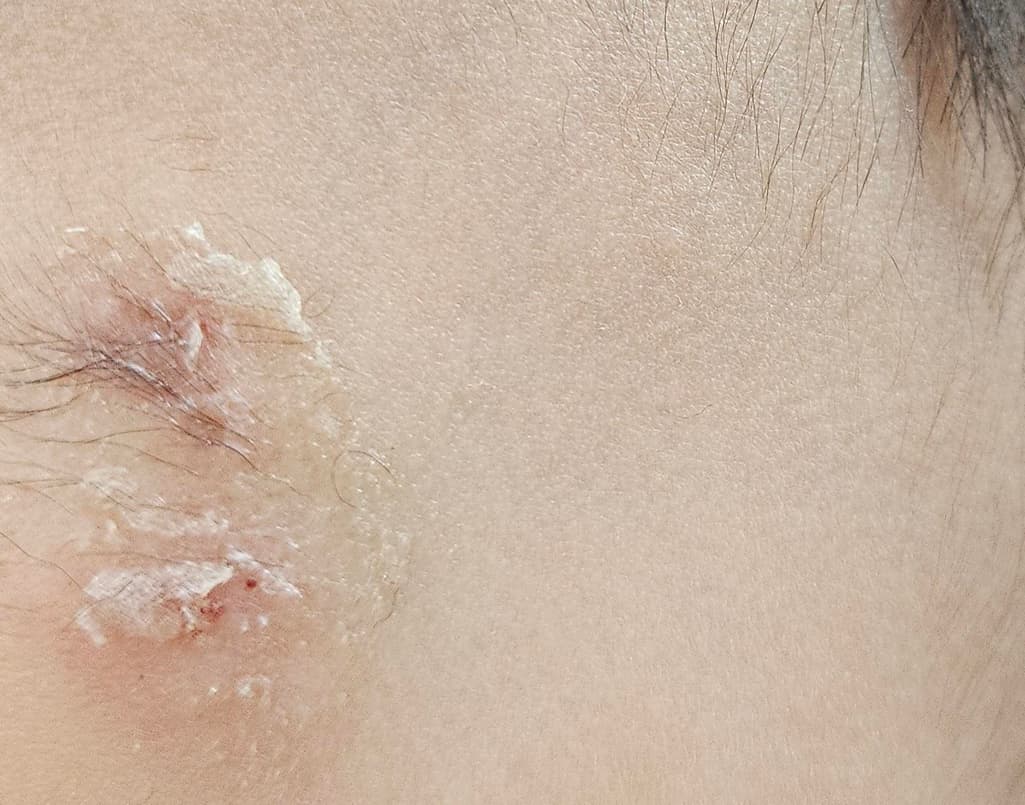 2번 째 사진